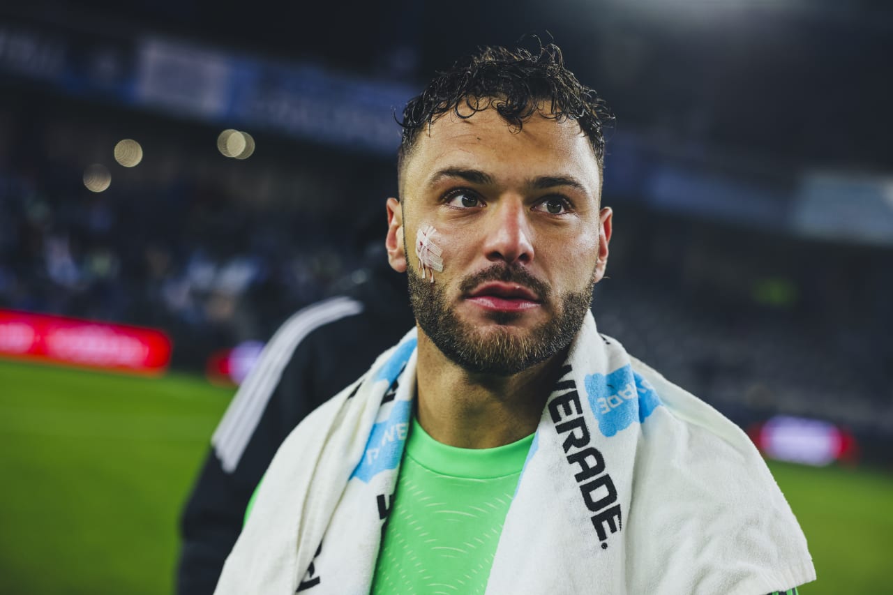 Sporting KC keeper John Pulskamp with bandages on his face after getting injured during the game.
