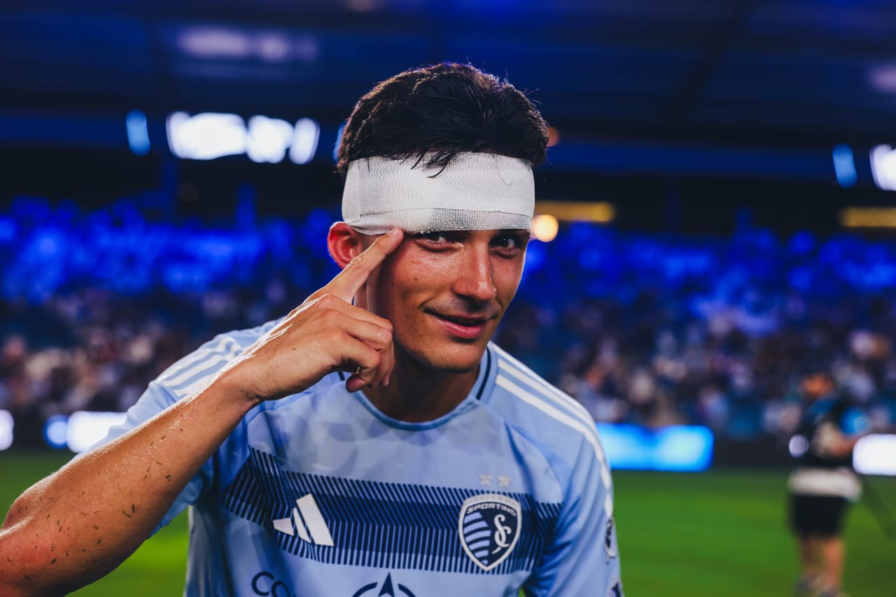 Midfielder Manu García shows off his bandage after the game.